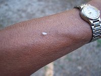 Hvidt insekt, har aldrig set dem andre steder end p� Korfu